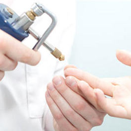 Criocirugía dermatológica